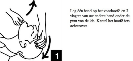 Kiss of Life Beademingsdoekje voor Hygiënisch Reanimeren Veilig Beademen met Eenrichtingsventiel - VCTparts.nl